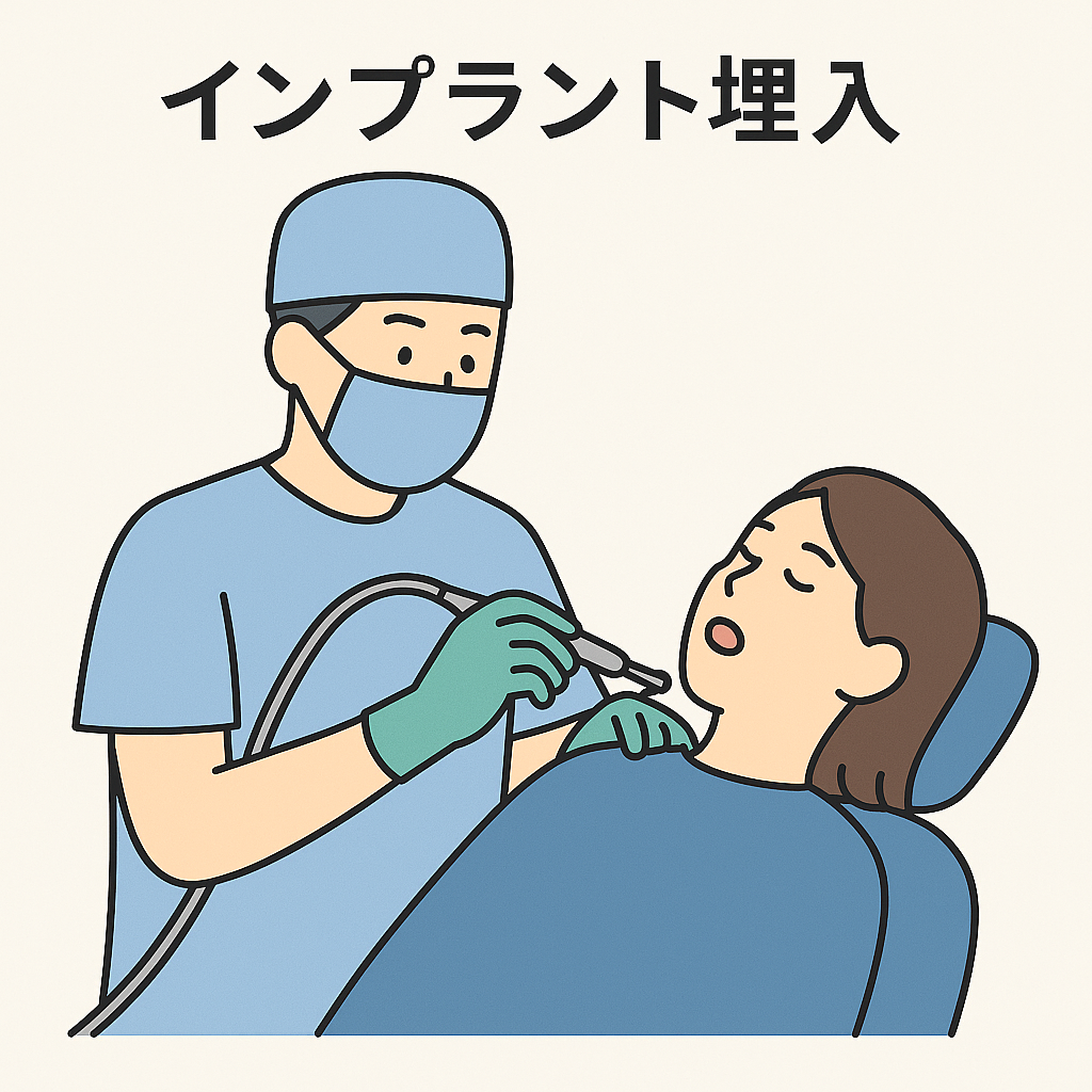 インプラント埋入